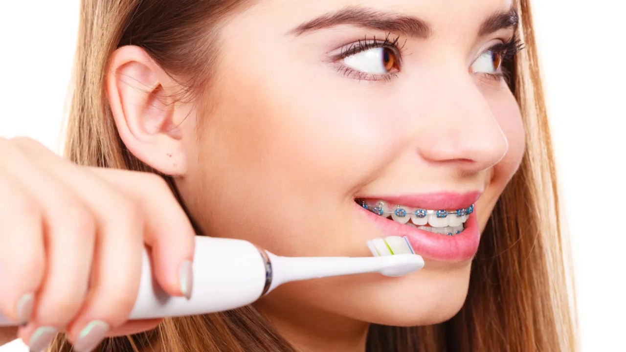 Czy można myć zęby z aparatem szczoteczką soniczną? Oto co musisz wiedzieć