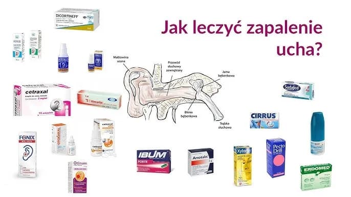 Jakie leki na zapalenie ucha u dziecka pomogą złagodzić ból?
