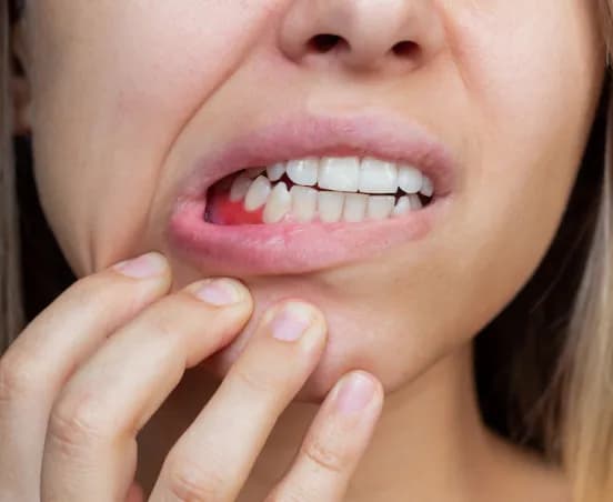 Czy rak dziąsła boli? Objawy, które mogą zaniepokoić każdego