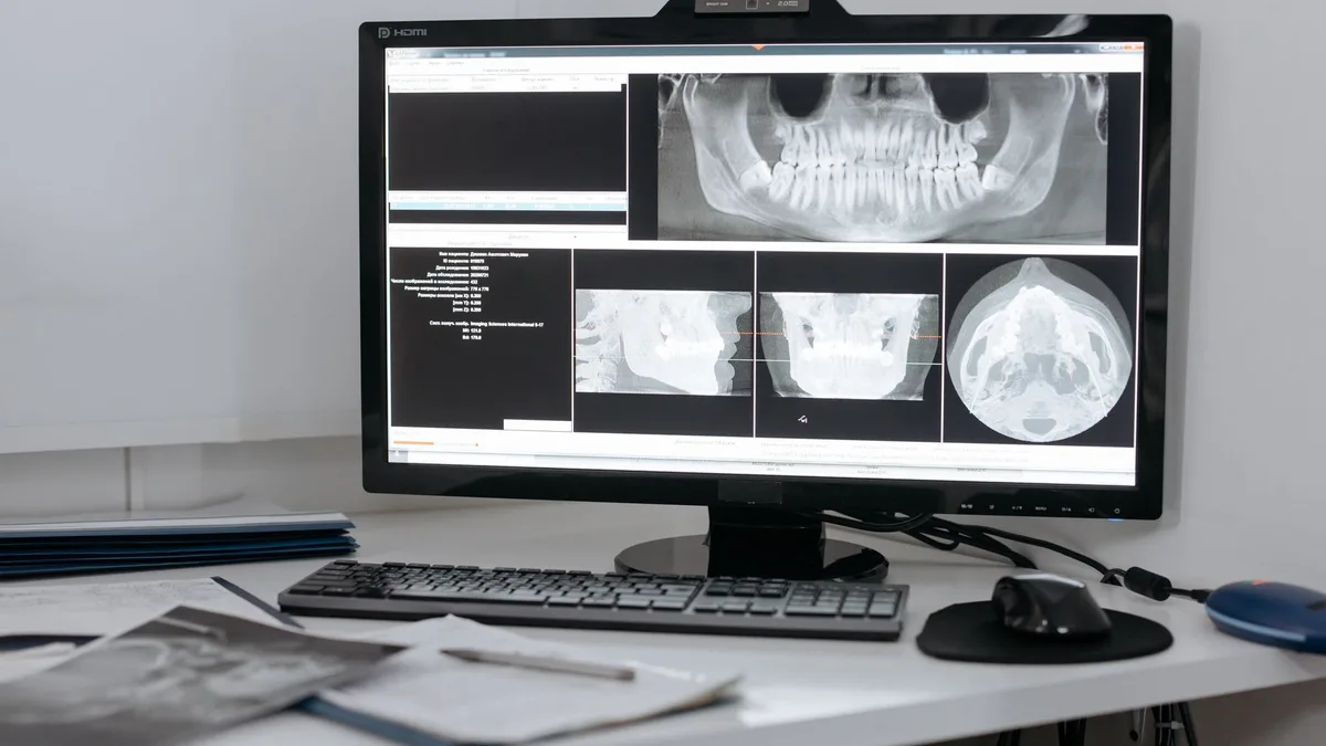 Monitor displaying dental X-ray images in a clinic setup for diagnostic purposes.