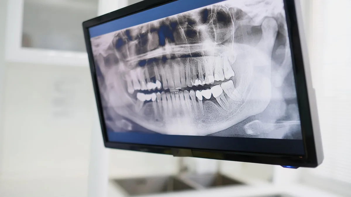 Close-up of a dental X-ray displayed on a monitor in a dental clinic setting, emphasizing dental care technology.