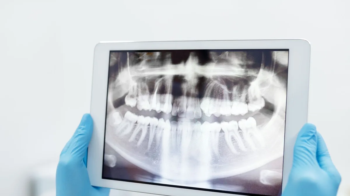 Blue-gloved hands holding a digital tablet displaying a detailed dental X-ray scan.