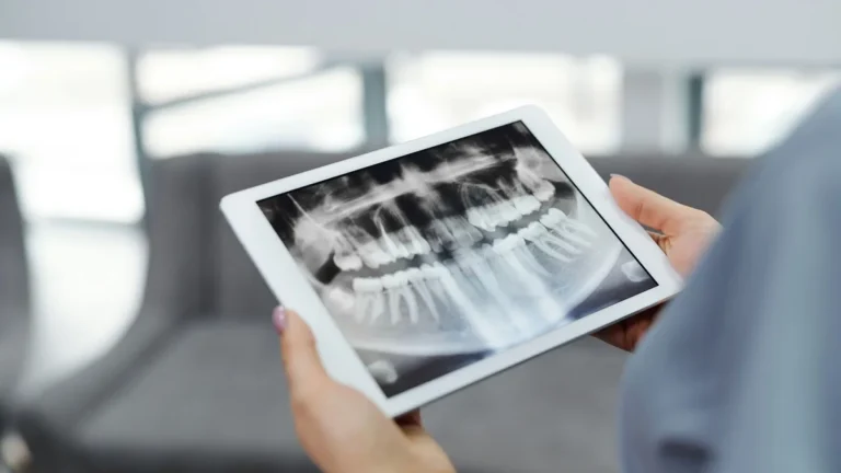 Close-up of hands holding a tablet displaying a dental X-ray indoors.