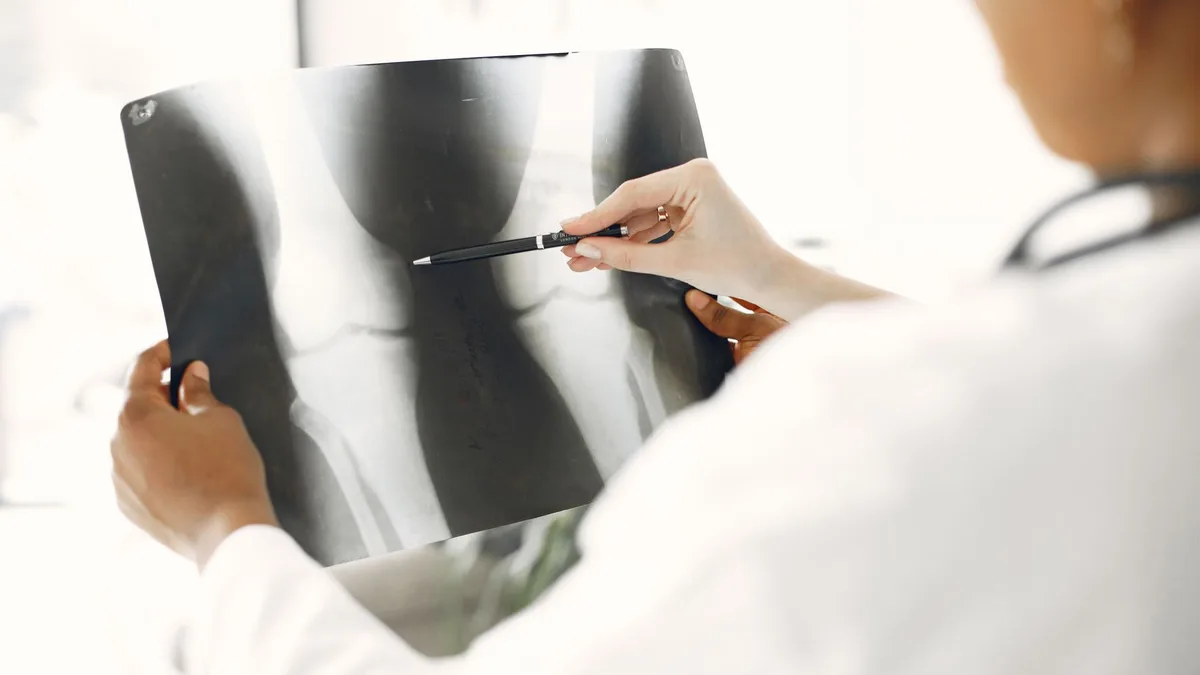A medical professional closely examines a leg X-ray, pointing out details with a pen.