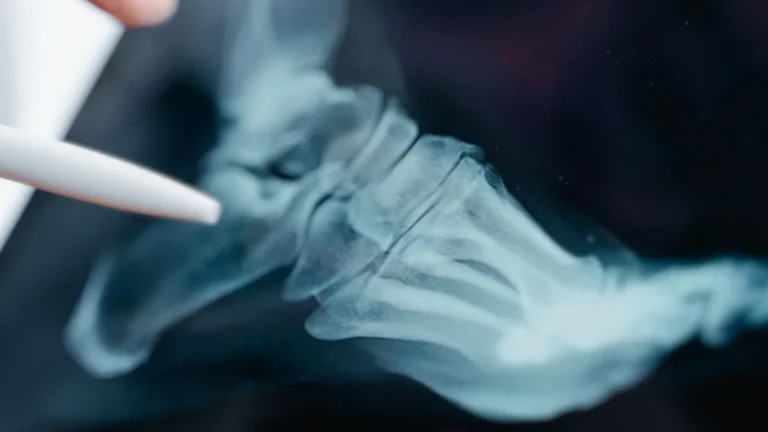 Detailed close-up of a foot x-ray displayed on a digital tablet screen.