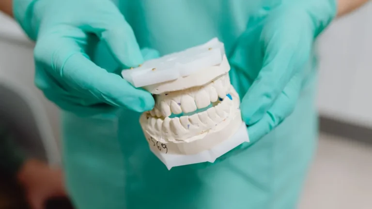Close-up view of a dental model held by a professional with green gloves in a clinic setting.