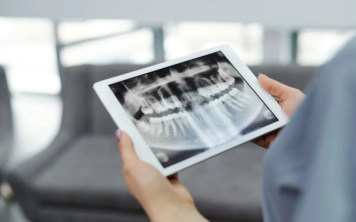 Dłonie trzymają tablet z panoramicznym zdjęciem rentgenowskim uzębienia